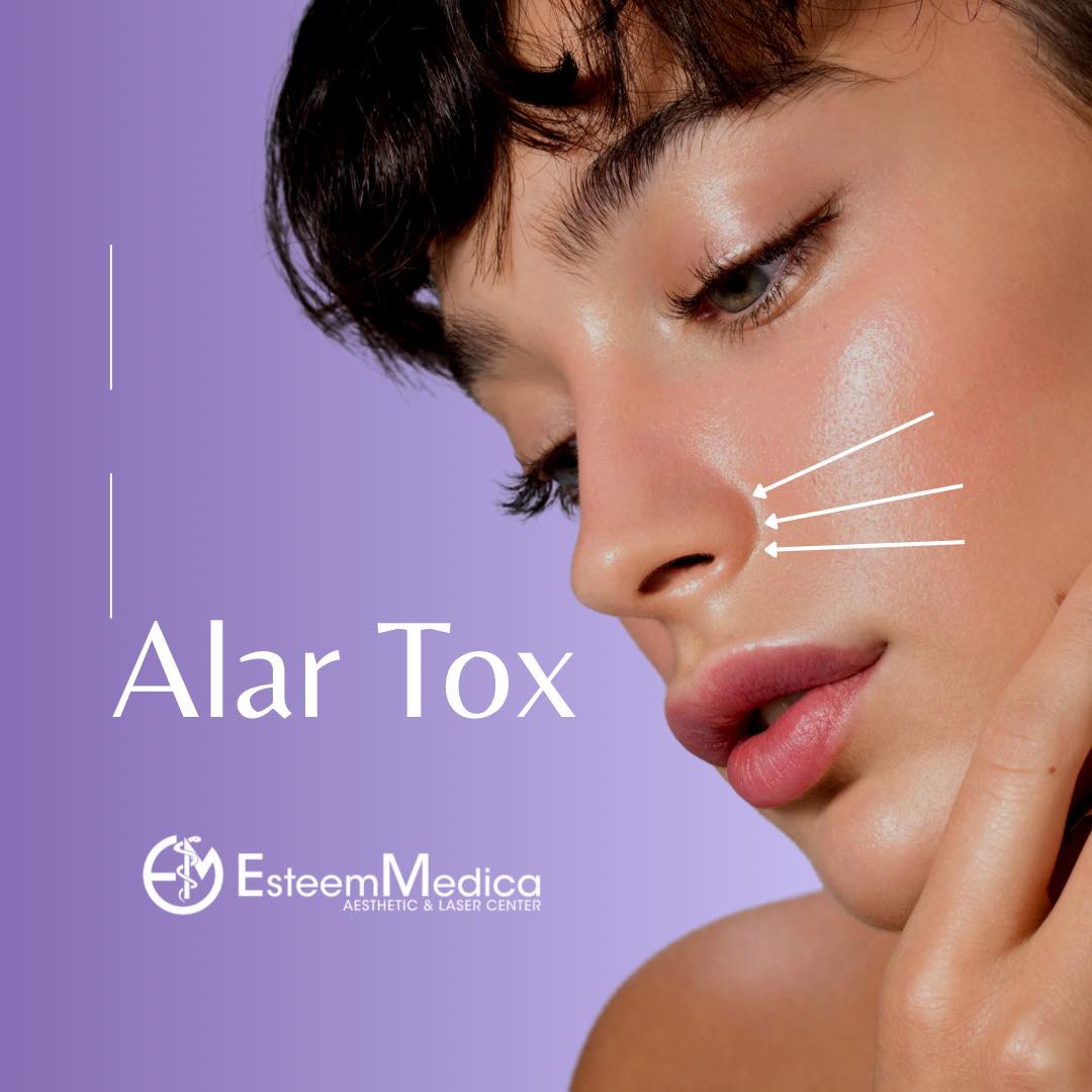 Alar Tox