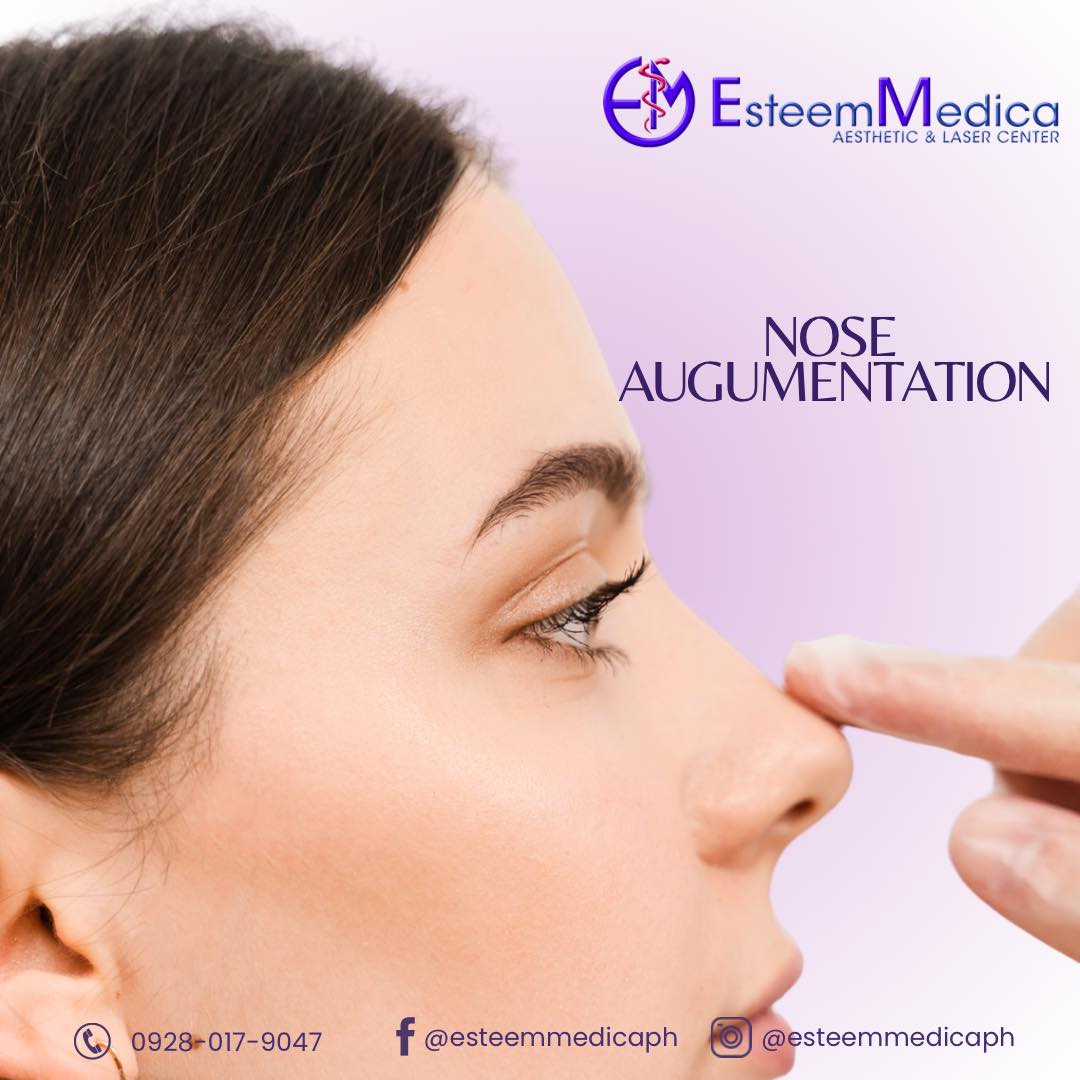 Nose Augmentation